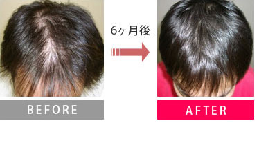 Before→６ヶ月後→After
