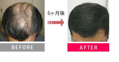 Before→６ヶ月後→After