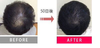 Before→50日後→After